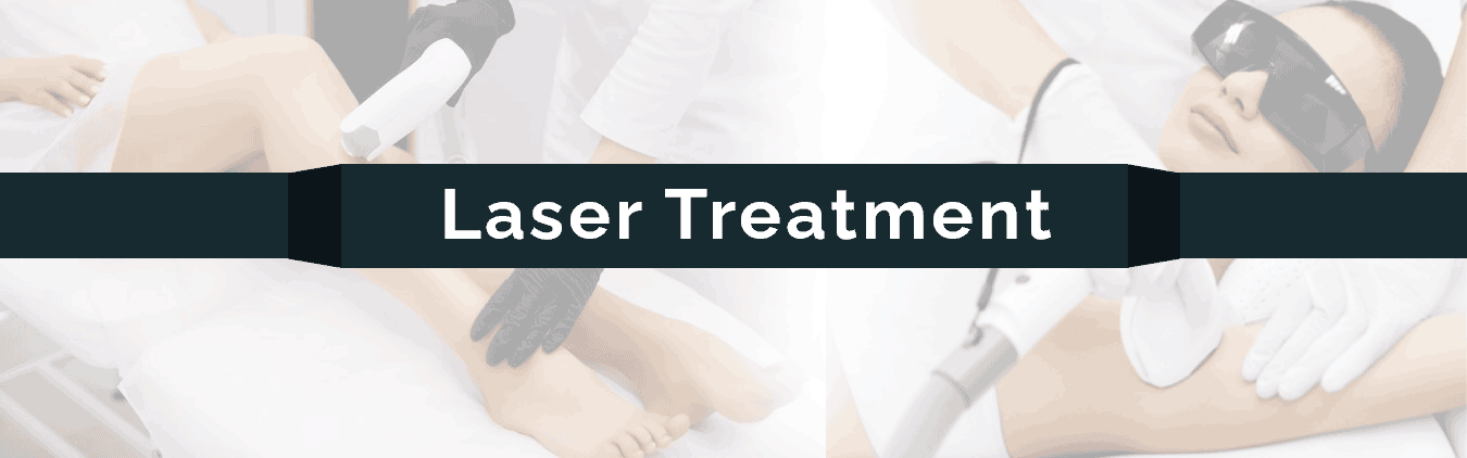 laser-treatment